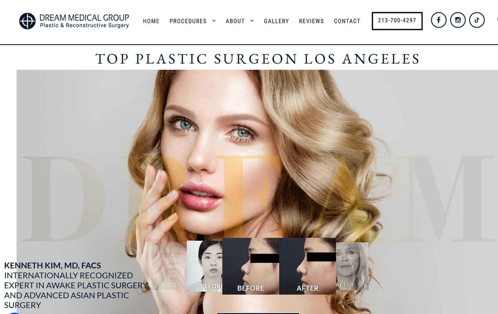 Kenneth Kim plastic surgery homepage website